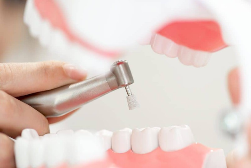 Dental Teeth Deep Cleaning in Turkey What is a Deep Dental Cleaning?
