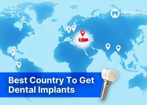 Best Country to get dental implants