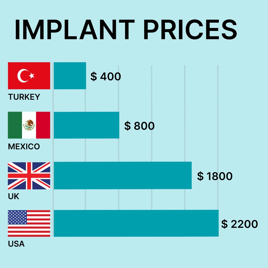 implant prices by country