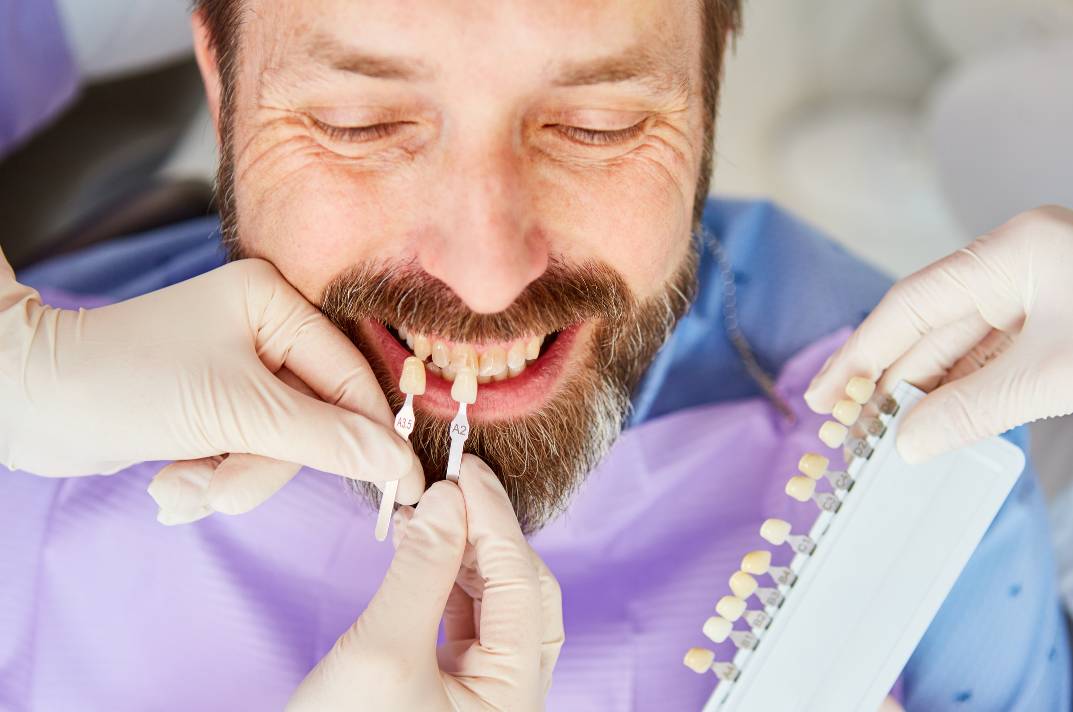 How much does a full set of veneers cost? Turkey