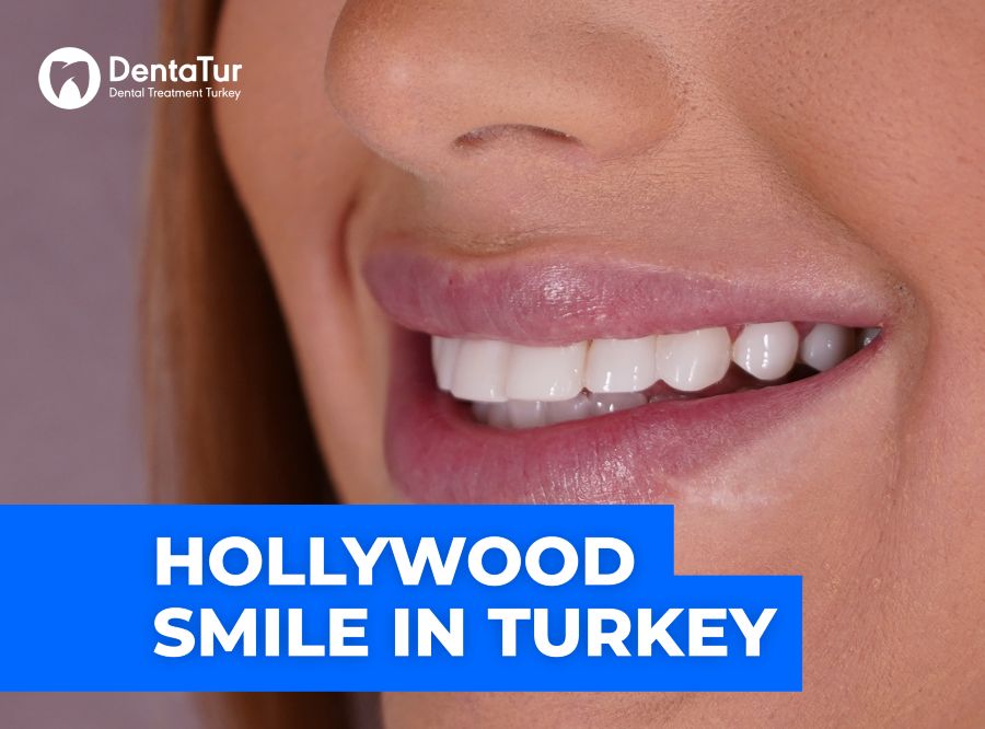 Hollywood smile in Turkey photo