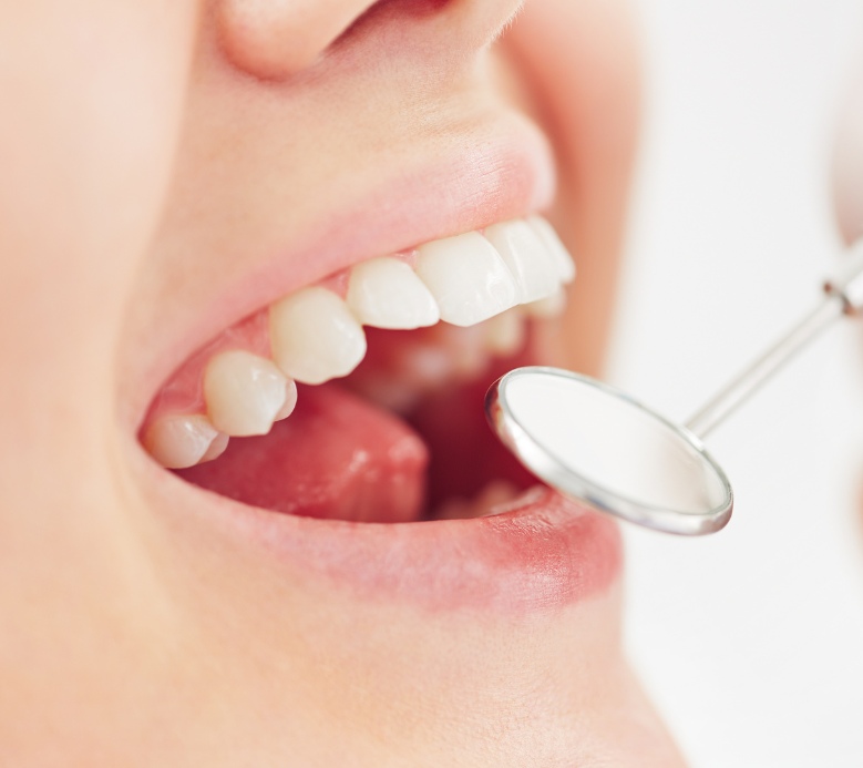 How much to get teeth done in Turkey and where can i get it?