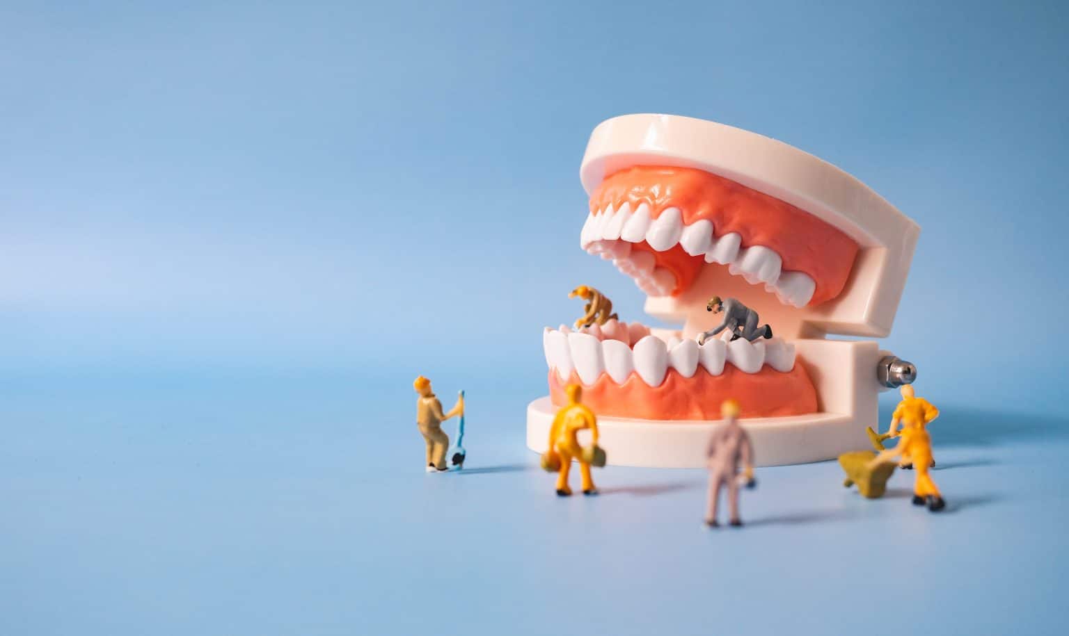 Full mouth reconstruction