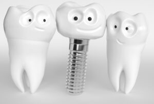 dental implant