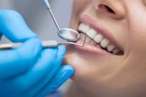 Getting Your Teeth Fixed in Turkey