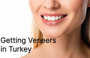 Getting Veneers in Turkey