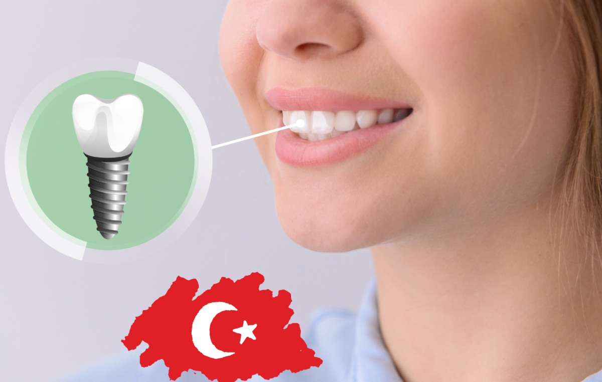 All-Inclusive Dental Implants in Turkey Packages