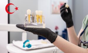 Teeth replacement ın Turkey