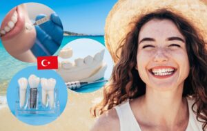 What Are Fake Teeth in Turkey