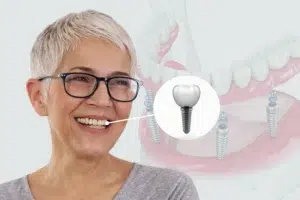 Dental Implant Happy patient