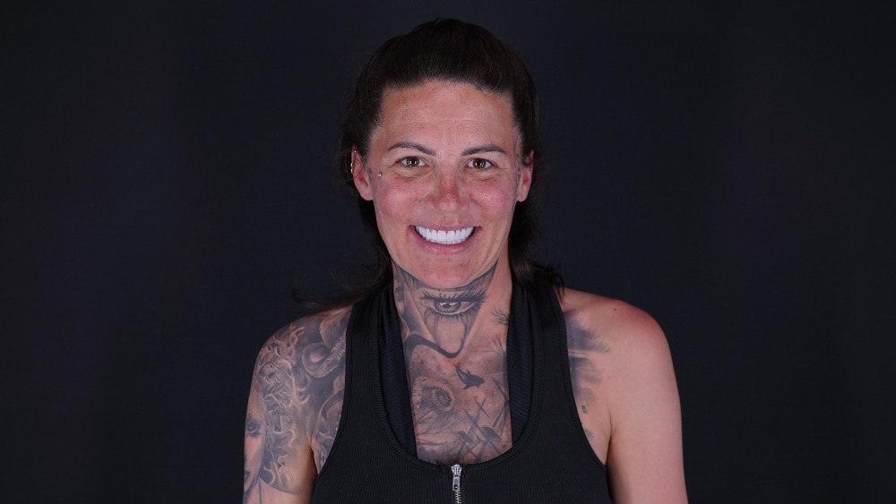 Gillian Ward Dental Implants Treatment Journey