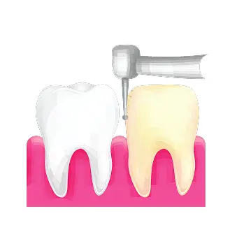 How are Dental Crowns made