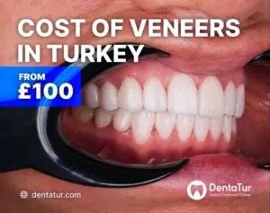 How much do Turkish Teeth cost?