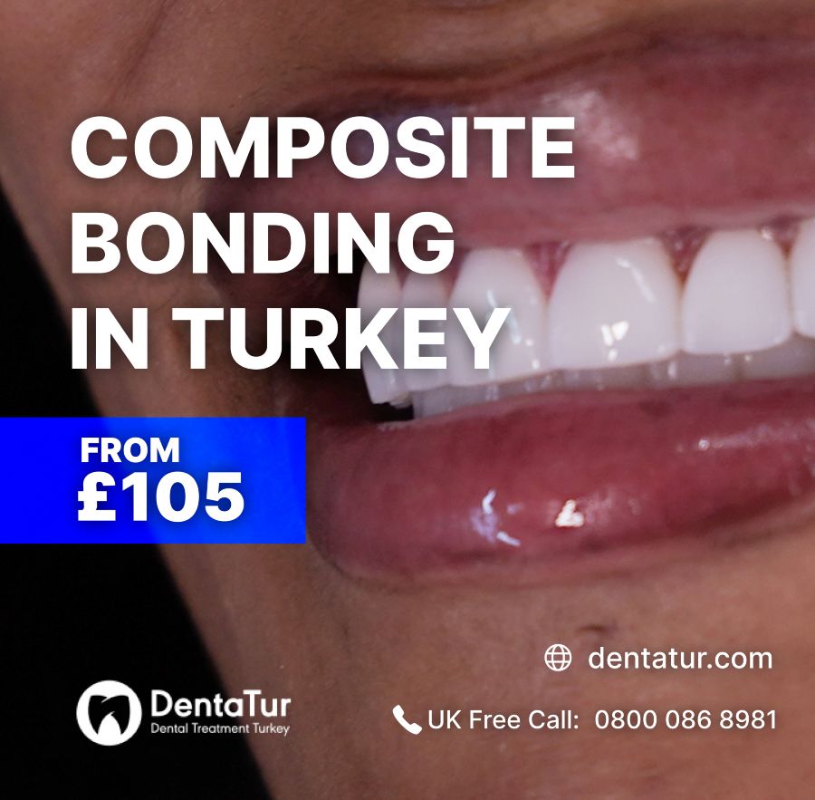 composite bonding treatment