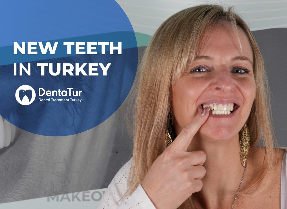 Smiling woman showing her new zirconium crowns after dental treatment in Turkey