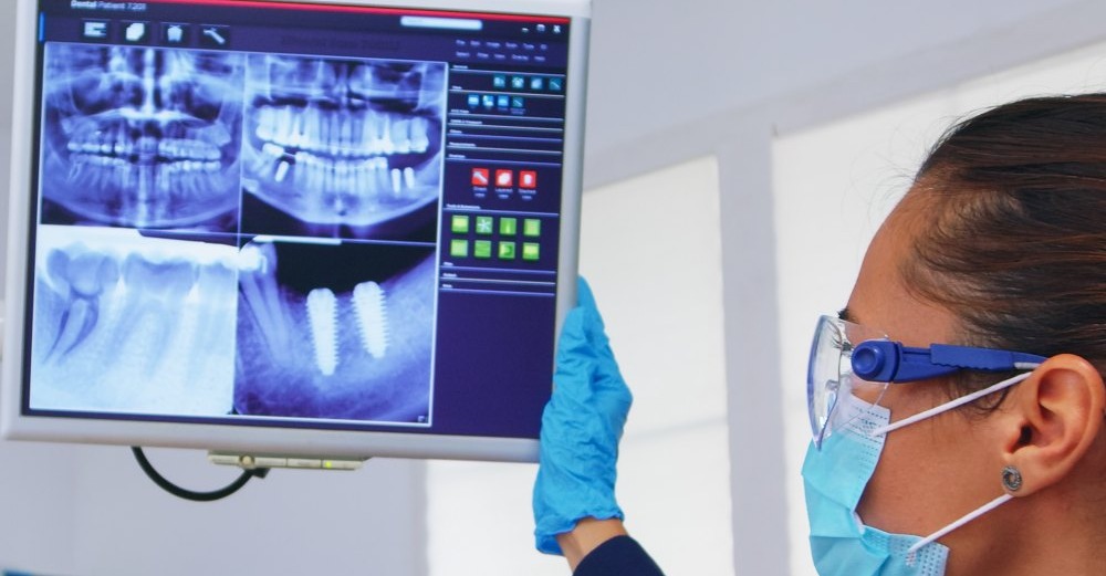 Dentist reviewing dental X-ray scans on a monitor at Dentatur Dental Clinic in Antalya