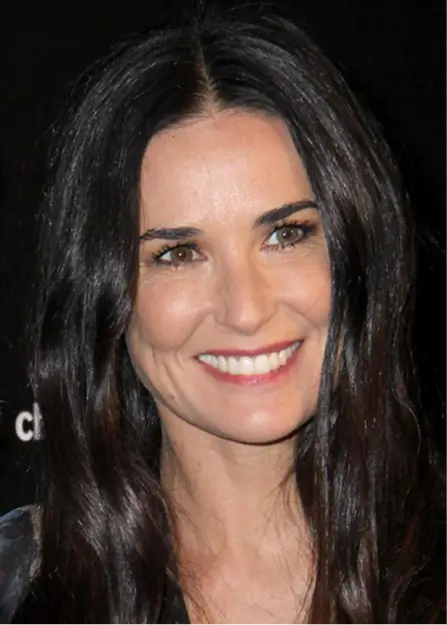 Demi Moore Teeth Veneers