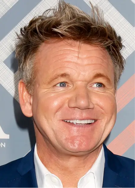 Gordon Ramsay Teeth Porcelain Veneers