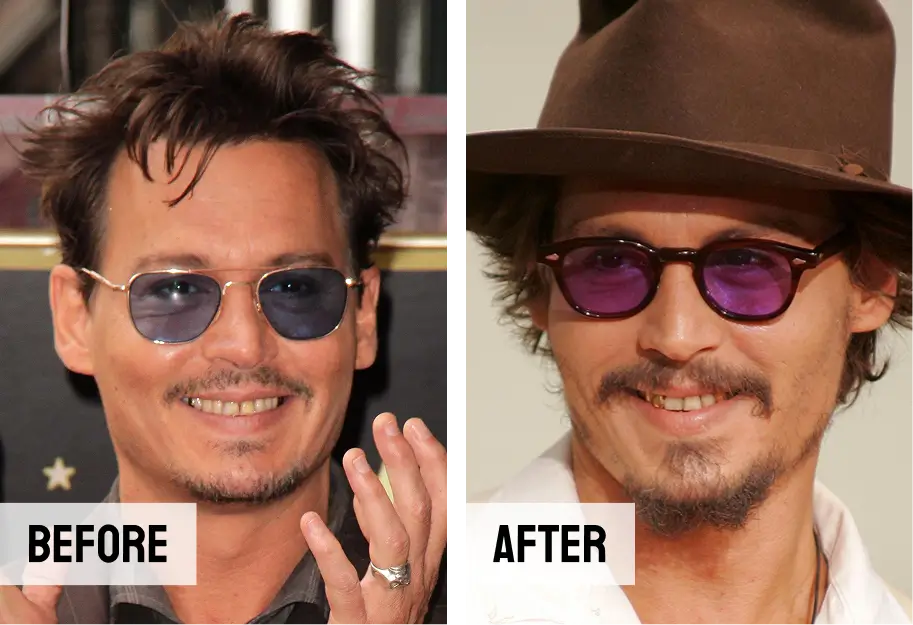 Johnny Depp Teeth Transformation