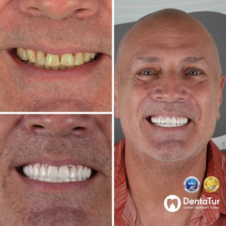 Turkish dentistry prices and reviews