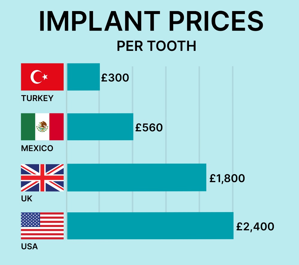 Implant prices per tooth