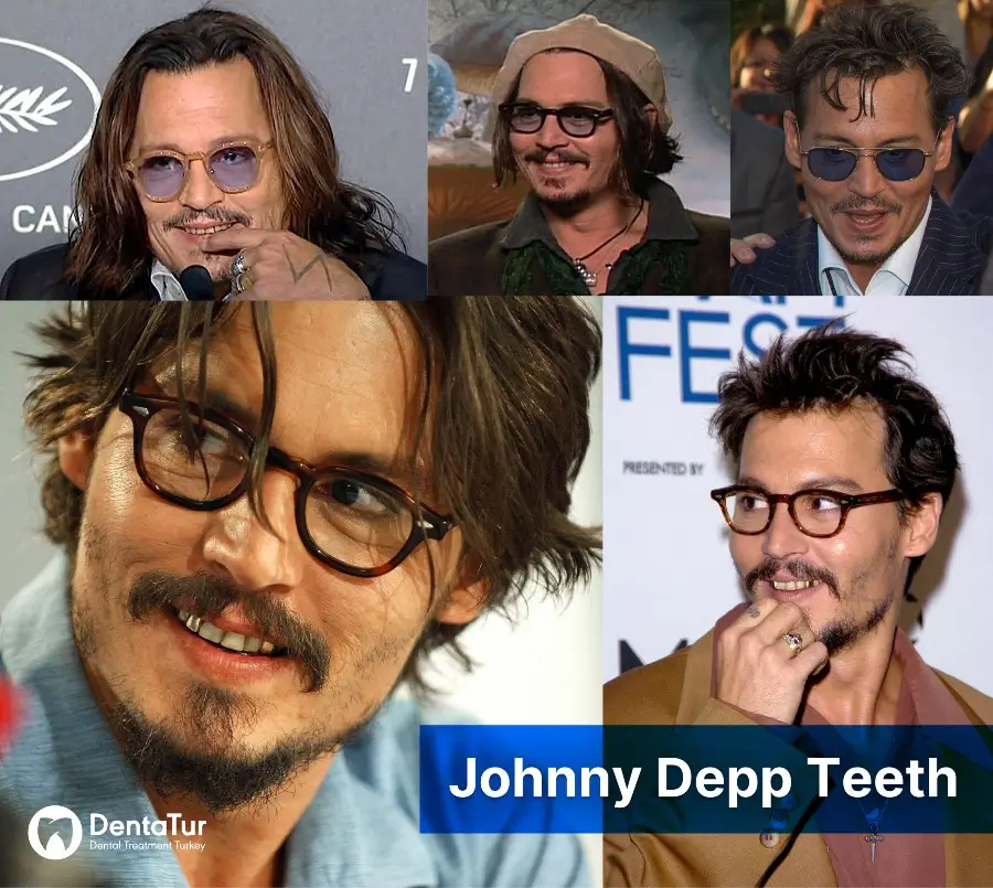 Johnny Depp Teeth