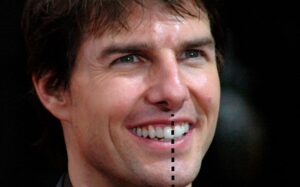 Tom Cruise Teeth: How He Got His Famous Hollywood Smile