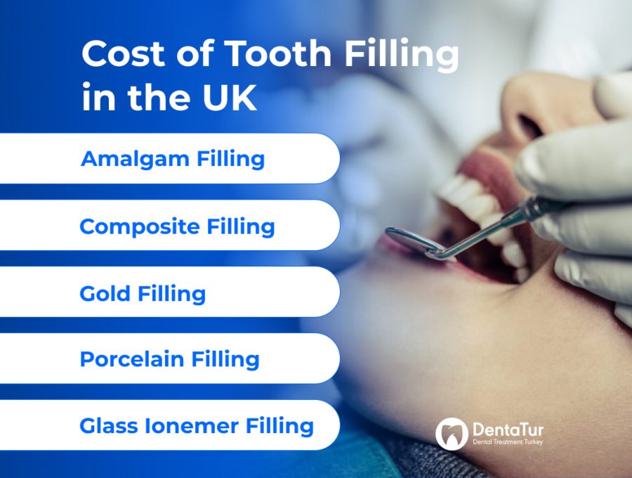 Cost of tooth filling in the UK