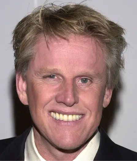 Gary Busey Teeth Before After
