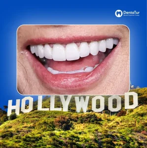 Hollywood Celebrities Getting Teeth